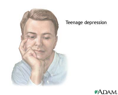 Teenage depression Teenage depression