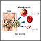 Bone-marrow transplant - series