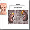 Adrenal glands